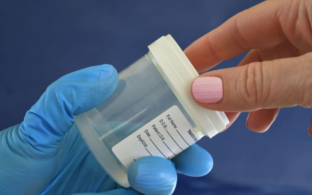 Understanding Different Types of Drug Tests and How They Work